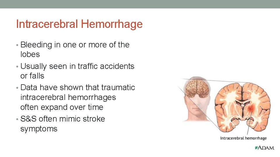 Intracerebral Hemorrhage • Bleeding in one or more of the lobes • Usually seen