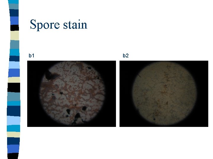 Spore stain b 1 b 2 