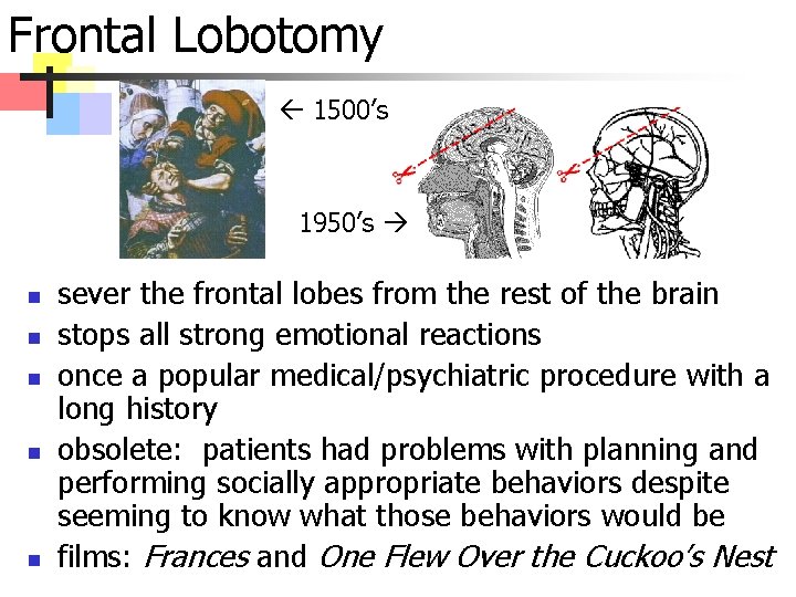 Frontal Lobotomy 1500’s 1950’s n n n sever the frontal lobes from the rest