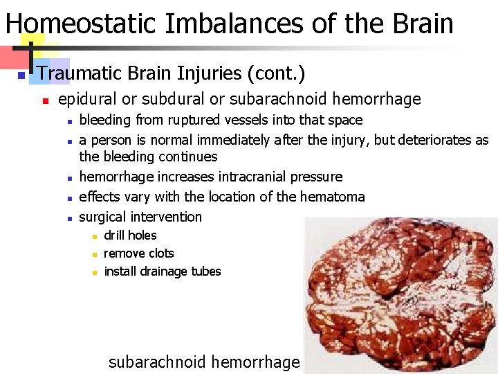 Homeostatic Imbalances of the Brain n Traumatic Brain Injuries (cont. ) n epidural or