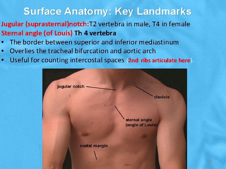 Surface Anatomy: Key Landmarks Jugular (suprasternal)notch: T 2 vertebra in male, T 4 in