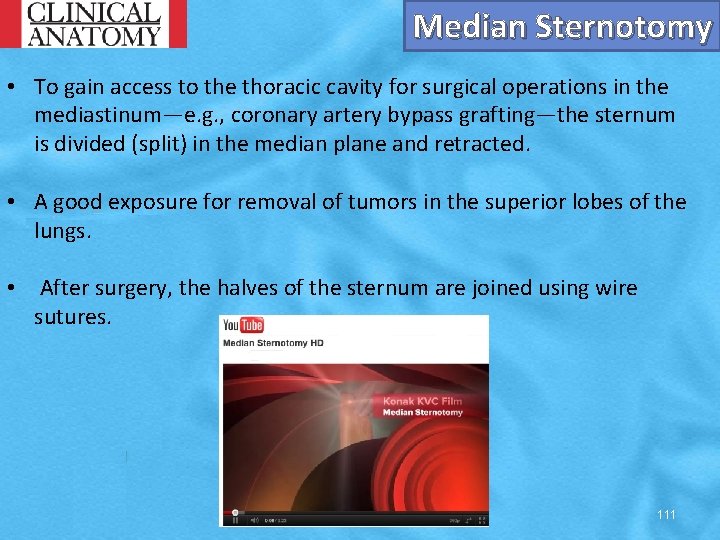 Median Sternotomy • To gain access to the thoracic cavity for surgical operations in