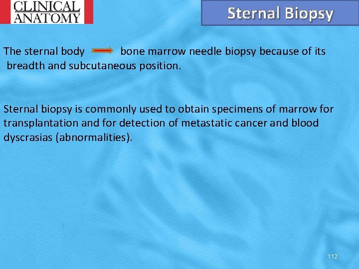 Sternal Biopsy The sternal body bone marrow needle biopsy because of its breadth and