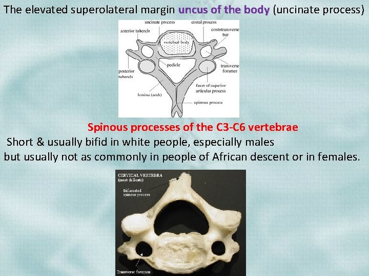 The elevated superolateral margin uncus of the body (uncinate process) Spinous processes of the