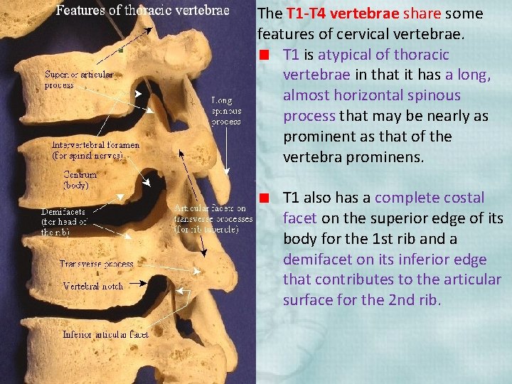 The T 1 -T 4 vertebrae share some features of cervical vertebrae. T 1