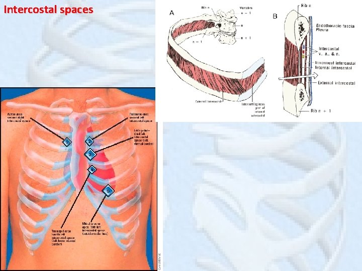 Intercostal spaces 