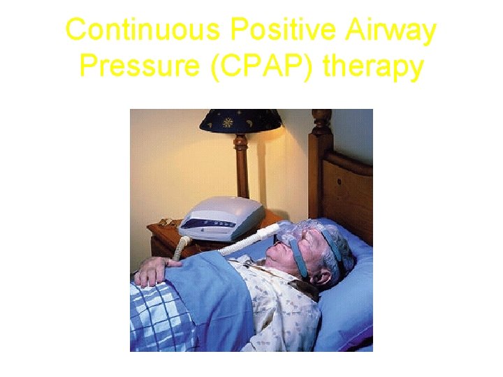 Continuous Positive Airway Pressure (CPAP) therapy 