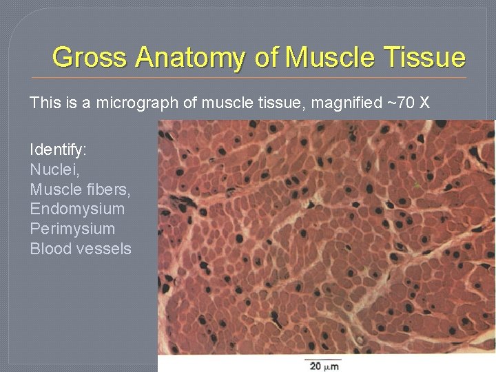 Gross Anatomy of Muscle Tissue This is a micrograph of muscle tissue, magnified ~70