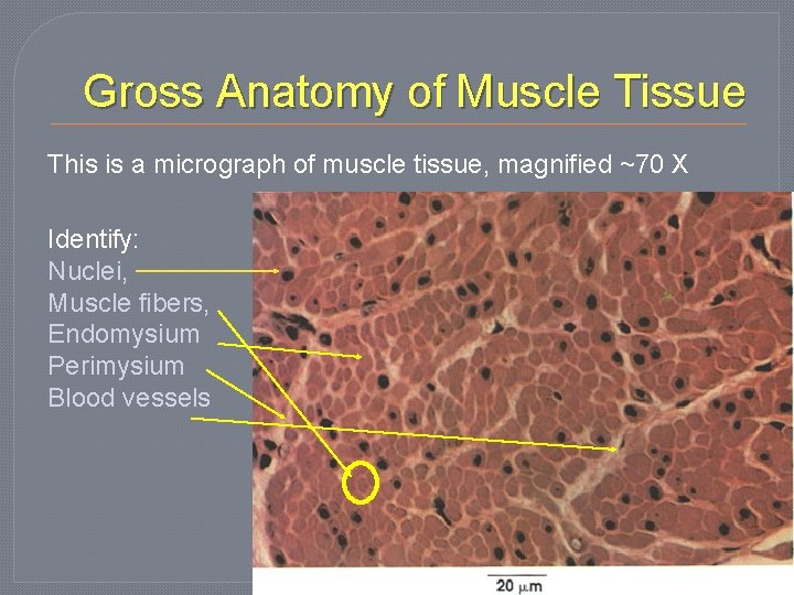 Gross Anatomy of Muscle Tissue This is a micrograph of muscle tissue, magnified ~70