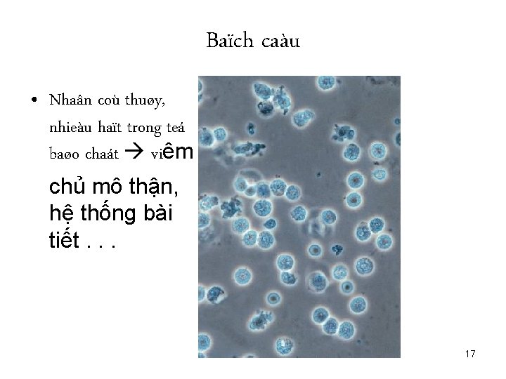 Baïch caàu • Nhaân coù thuøy, nhieàu haït trong teá baøo chaát viêm chủ