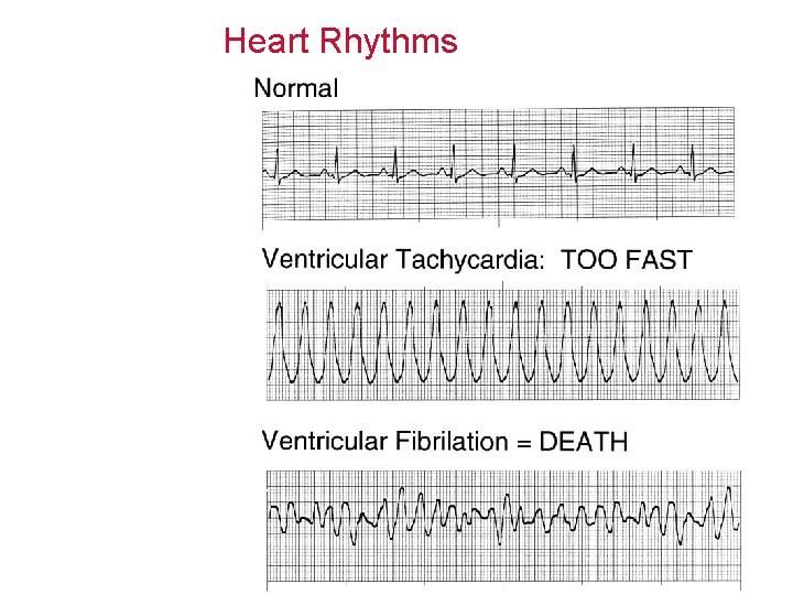 Heart Rhythms 