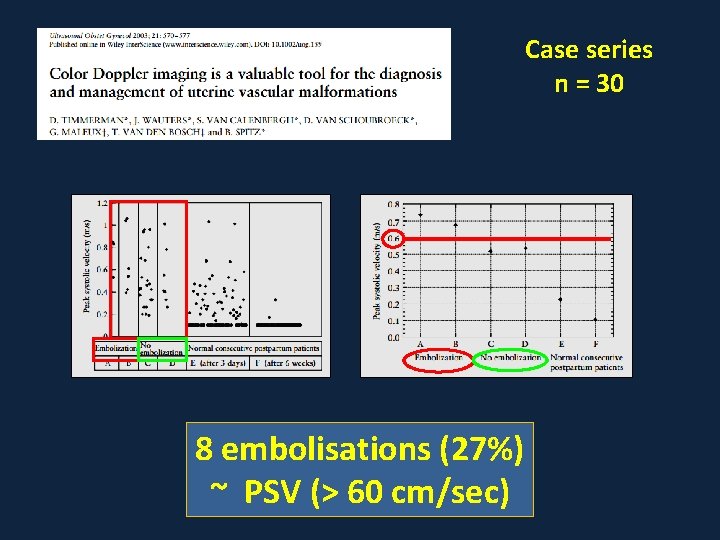 Case series n = 30 8 embolisations (27%) ~ PSV (> 60 cm/sec) 