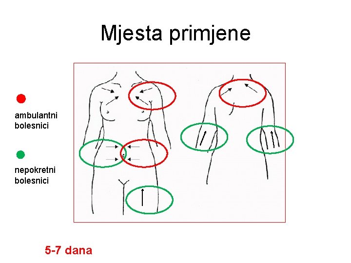 Mjesta primjene ● ambulantni bolesnici ● nepokretni bolesnici 5 -7 dana 