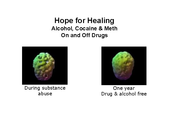 Hope for Healing Alcohol, Cocaine & Meth On and Off Drugs During substance abuse