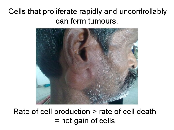 Cells that proliferate rapidly and uncontrollably can form tumours. Rate of cell production >