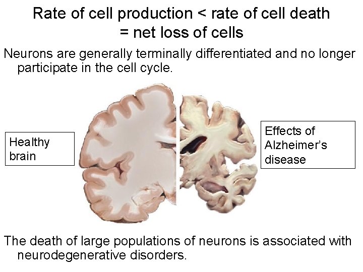Rate of cell production < rate of cell death = net loss of cells