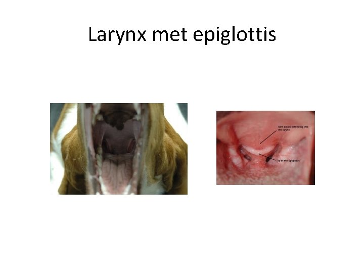 Larynx met epiglottis 