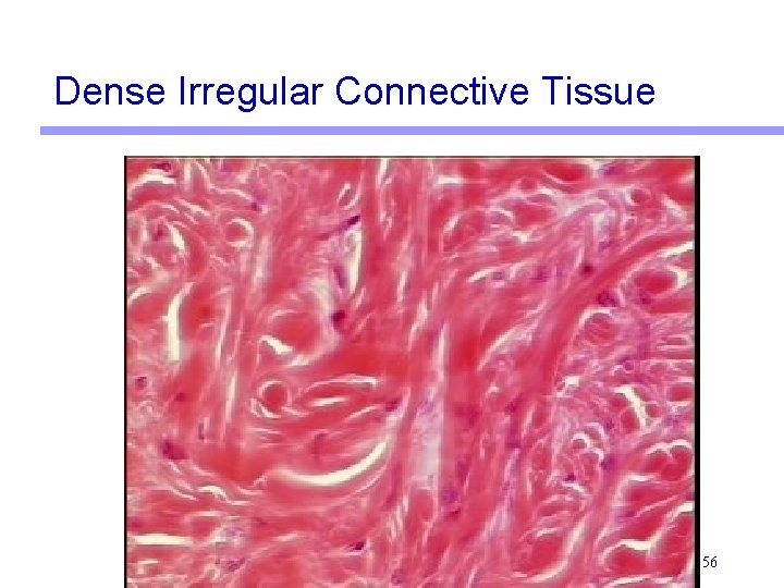 Dense Irregular Connective Tissue 56 