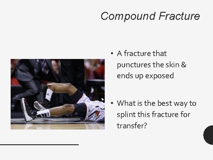 Compound Fracture • A fracture that punctures the skin & ends up exposed •