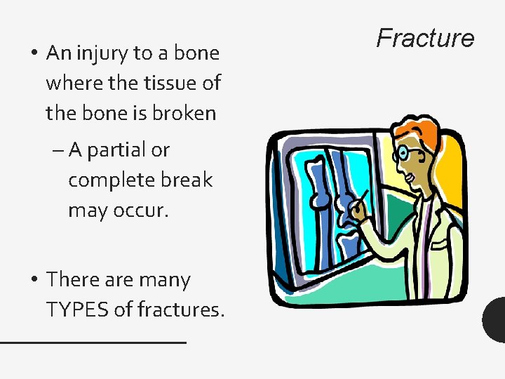  • An injury to a bone where the tissue of the bone is