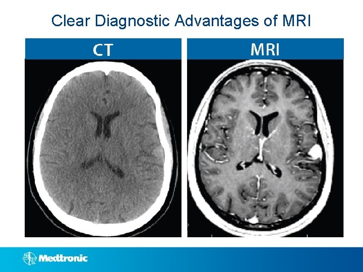 Clear Diagnostic Advantages of MRI 