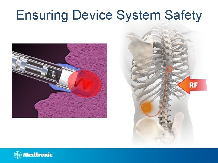 Ensuring Device System Safety 