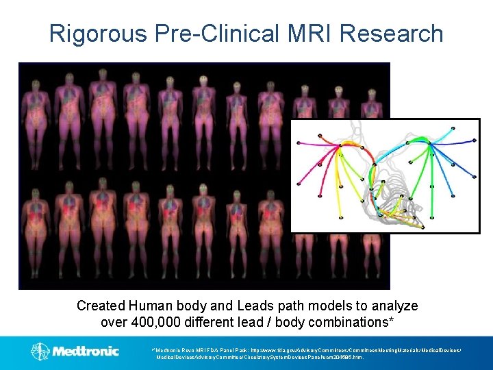Rigorous Pre-Clinical MRI Research Created Human body and Leads path models to analyze over