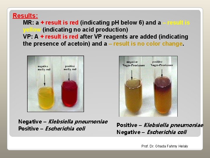 Results: MR: a + result is red (indicating p. H below 6) and a