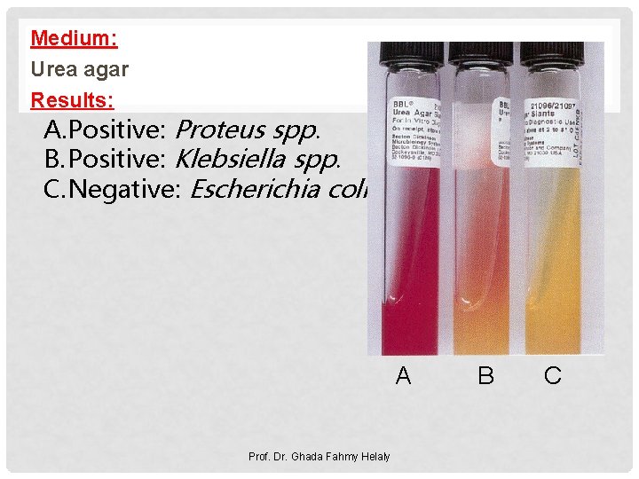 Medium: Urea agar Results: A. Positive: Proteus spp. B. Positive: Klebsiella spp. C. Negative: