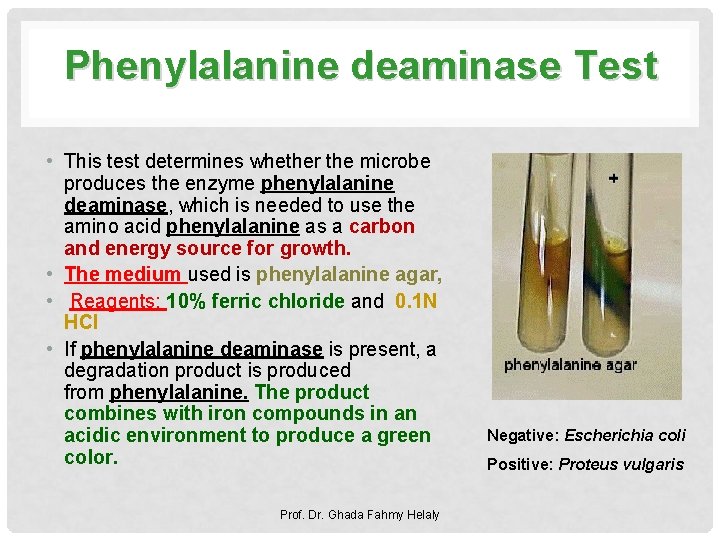 Phenylalanine deaminase Test • This test determines whether the microbe produces the enzyme phenylalanine