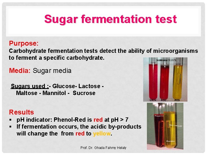 Sugar fermentation test Purpose: Carbohydrate fermentation tests detect the ability of microorganisms to ferment