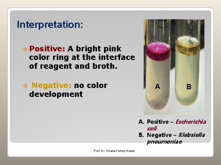 Interpretation: v Positive: A bright pink color ring at the interface of reagent and