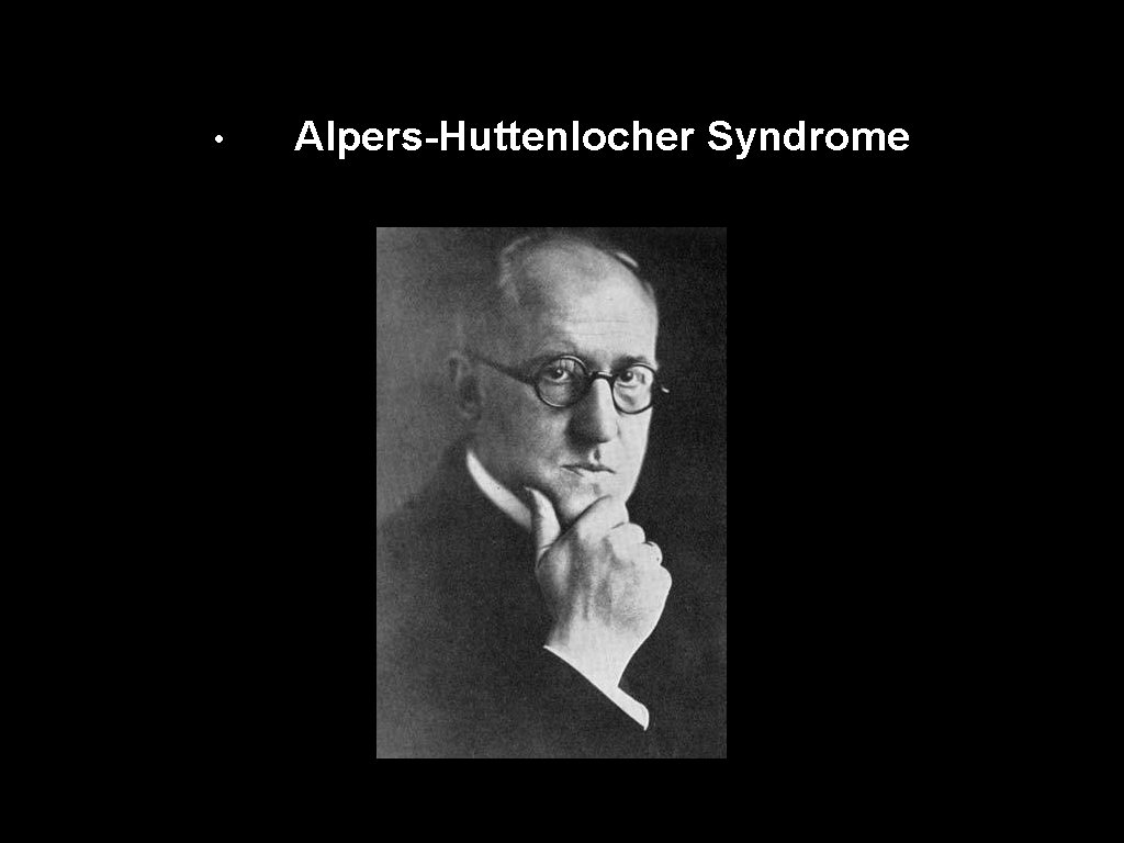 • Alpers-Huttenlocher Syndrome 