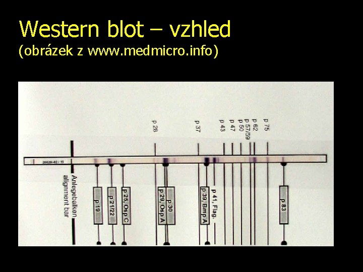 Western blot – vzhled (obrázek z www. medmicro. info) 