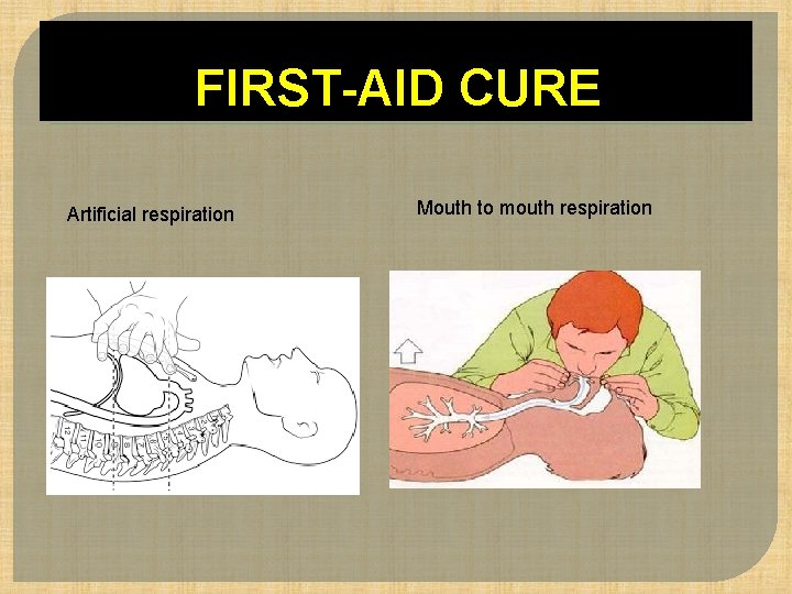 FIRST-AID CURE Artificial respiration Mouth to mouth respiration 