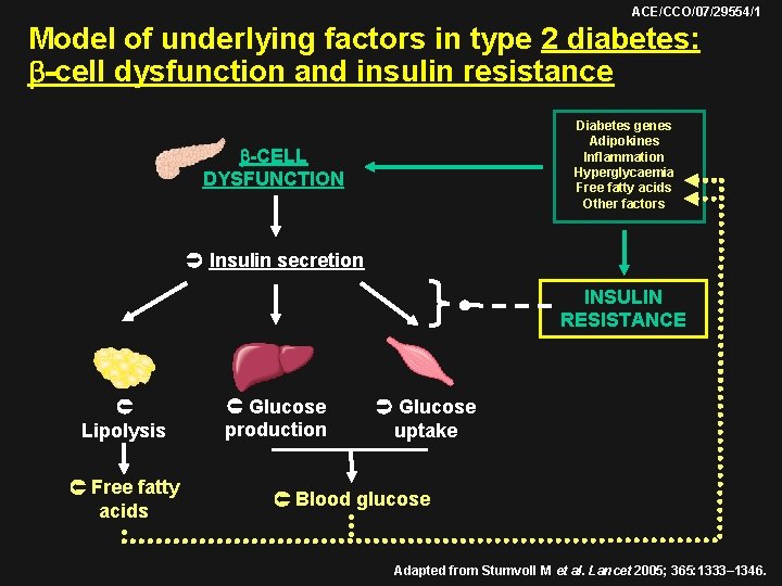 ACE/CCO/07/29554/1 Model of underlying factors in type 2 diabetes: -cell dysfunction and insulin resistance