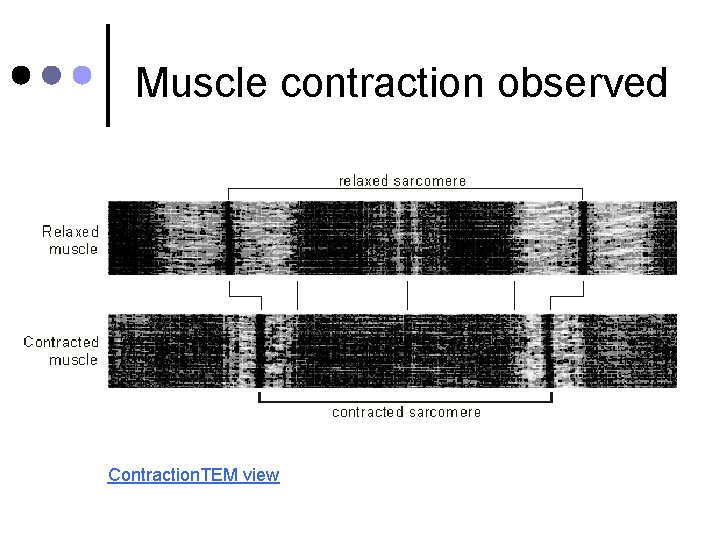 Muscle contraction observed Contraction. TEM view 