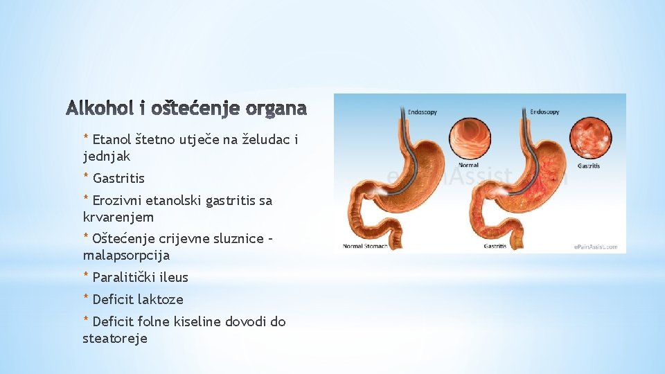 * Etanol štetno utječe na želudac i jednjak * Gastritis * Erozivni etanolski gastritis