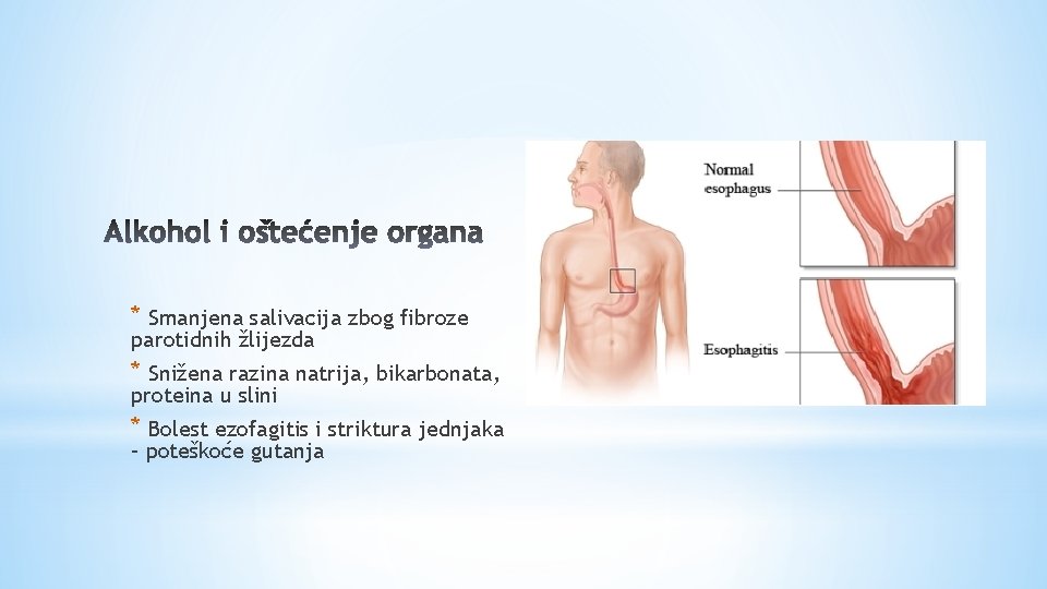 * Smanjena salivacija zbog fibroze parotidnih žlijezda * Snižena razina natrija, bikarbonata, proteina u