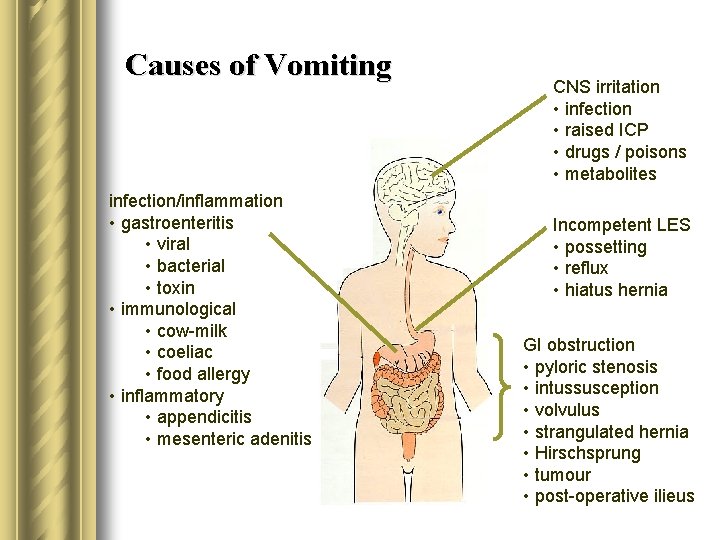 Causes of Vomiting infection/inflammation • gastroenteritis • viral • bacterial • toxin • immunological