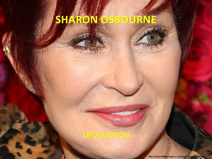 SHARON OSBOURNE LIPOSUCTION http: //www. huffingtonpost. co. uk/news/sharon-osbourne/ 
