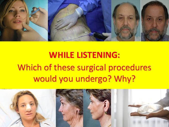 WHILE LISTENING: Which of these surgical procedures would you undergo? Why? 
