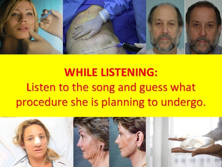 WHILE LISTENING: Listen to the song and guess what procedure she is planning to