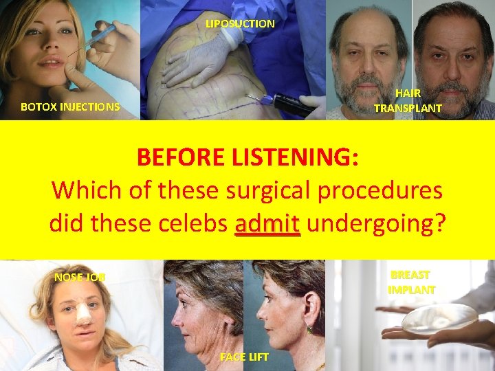 LIPOSUCTION HAIR TRANSPLANT BOTOX INJECTIONS BEFORE LISTENING: Which of these surgical procedures did these