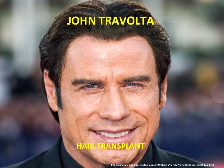 JOHN TRAVOLTA HAIR TRANSPLANT http: //www. viewheadlines. com/topstories/999334/John-Travolta-Turns-60 -Dreams-of-007 -Role. html 