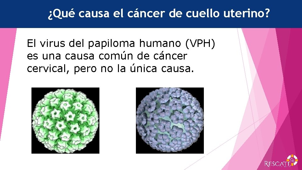 ¿Qué causa el cáncer de cuello uterino? El virus del papiloma humano (VPH) es