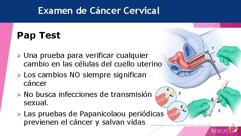 Examen de Cáncer Cervical Pap Test Ø Una prueba para verificar cualquier cambio en