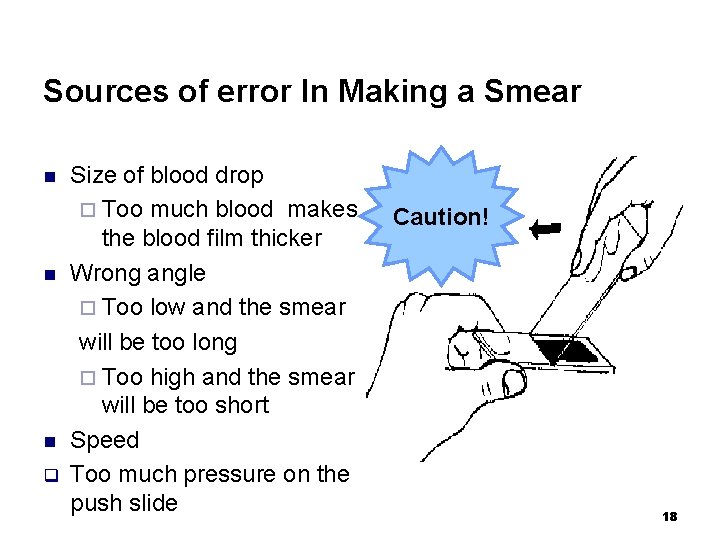 Sources of error In Making a Smear n n n q Size of blood