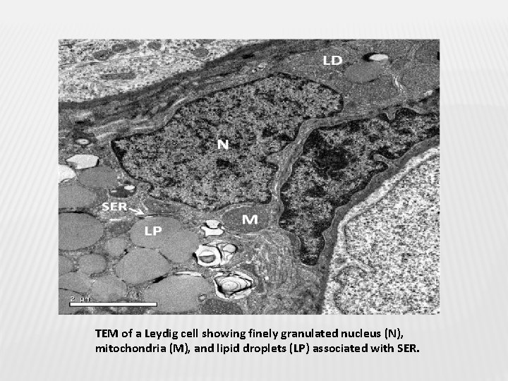 TEM of a Leydig cell showing finely granulated nucleus (N), mitochondria (M), and lipid