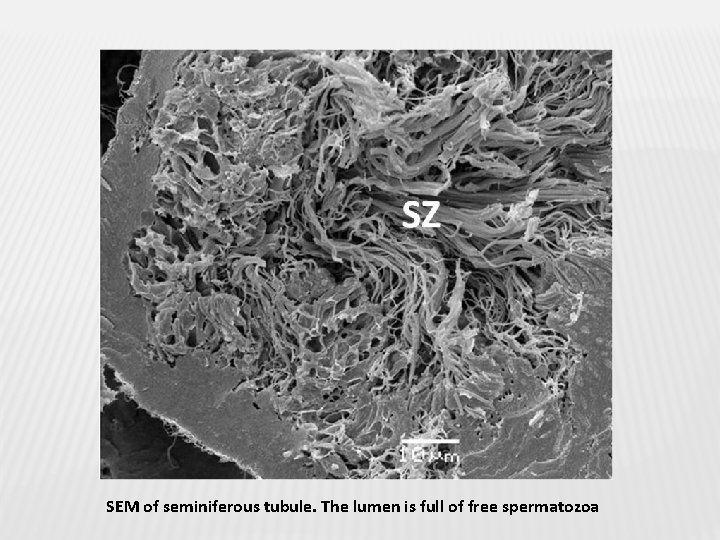 SEM of seminiferous tubule. The lumen is full of free spermatozoa 